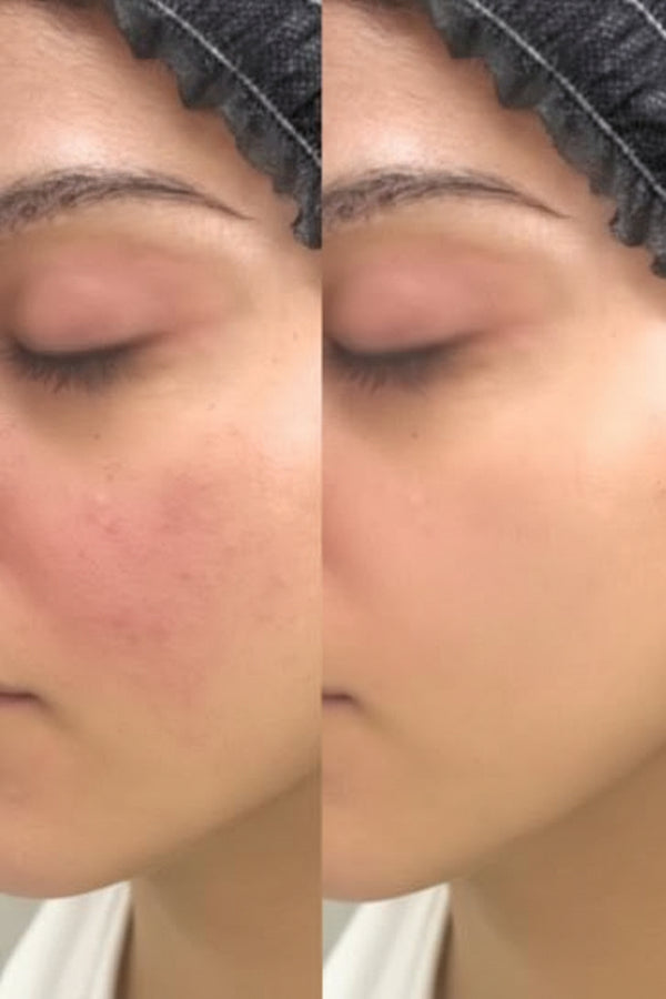 El producto que utilizaba antes me irritaba mucho la piel, con este volvío el brillo y ya no me irrita más.